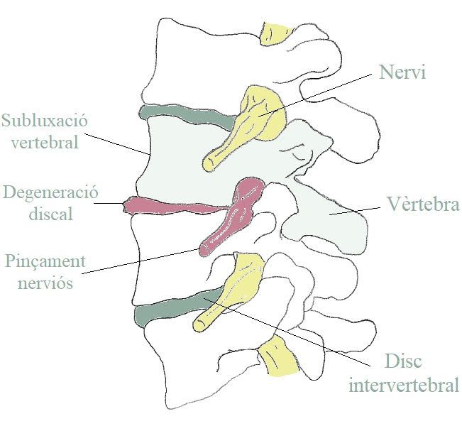 Columna vertebral